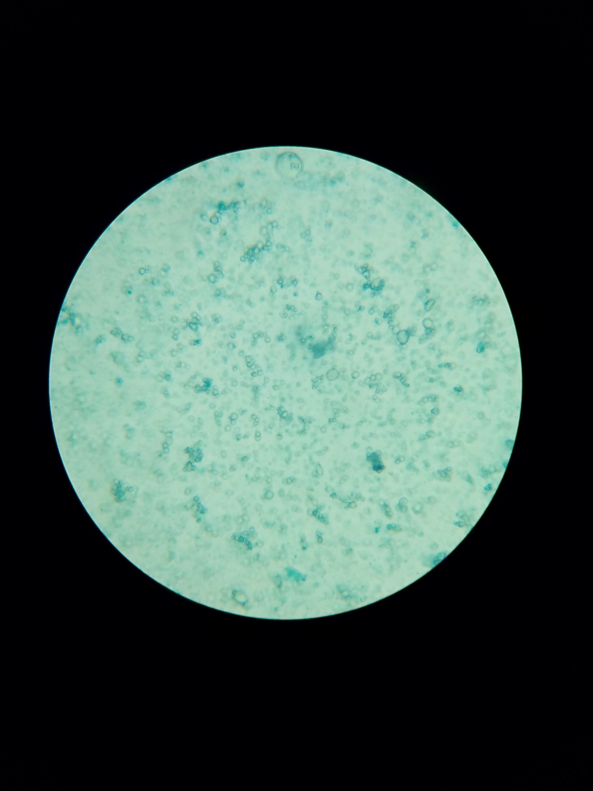 Large view of yeast cells and bits of blue gluten+flour from fed starter. Methylene blue stain